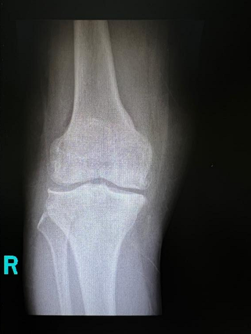 图片 1.png 图片 1.png