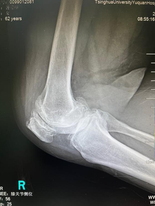 图片 2.png 图片 2.png