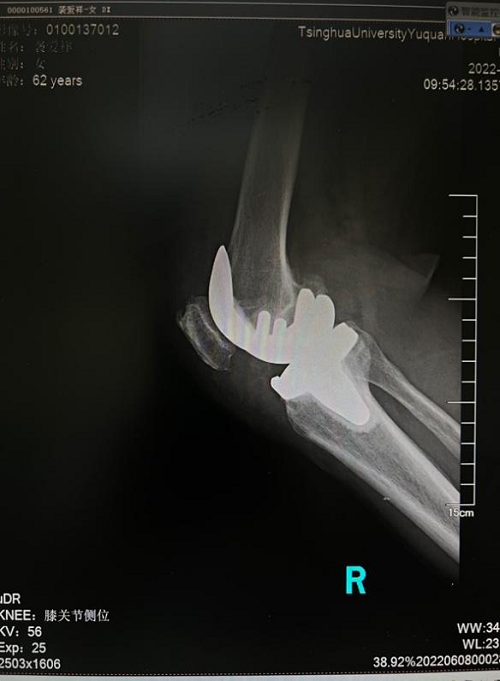 图片 4.png 图片 4.png