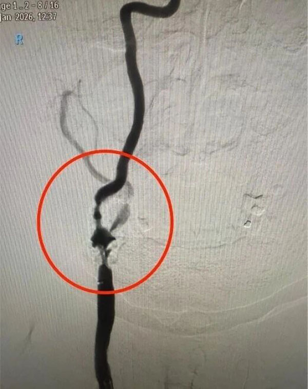 DM_20260316093715_001.jpg DM_20260316093715_001.jpg